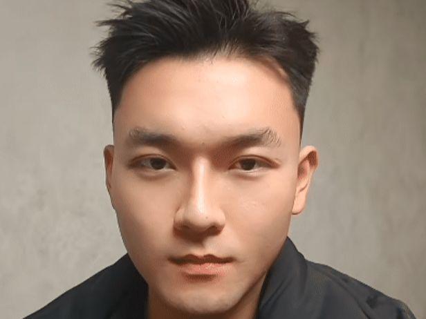 手指肿得像鸡蛋不开口被质疑遭割舌！球王会网页版杨泽琪展示身上伤痕自曝(图2)